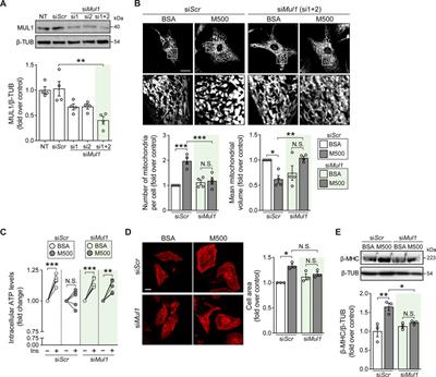 Myristate induces mitochondrial fragmentation and cardiomyocyte hypertrophy through mitochondrial E3 ubiquitin ligase <mark class="highlighted">MUL1</mark>